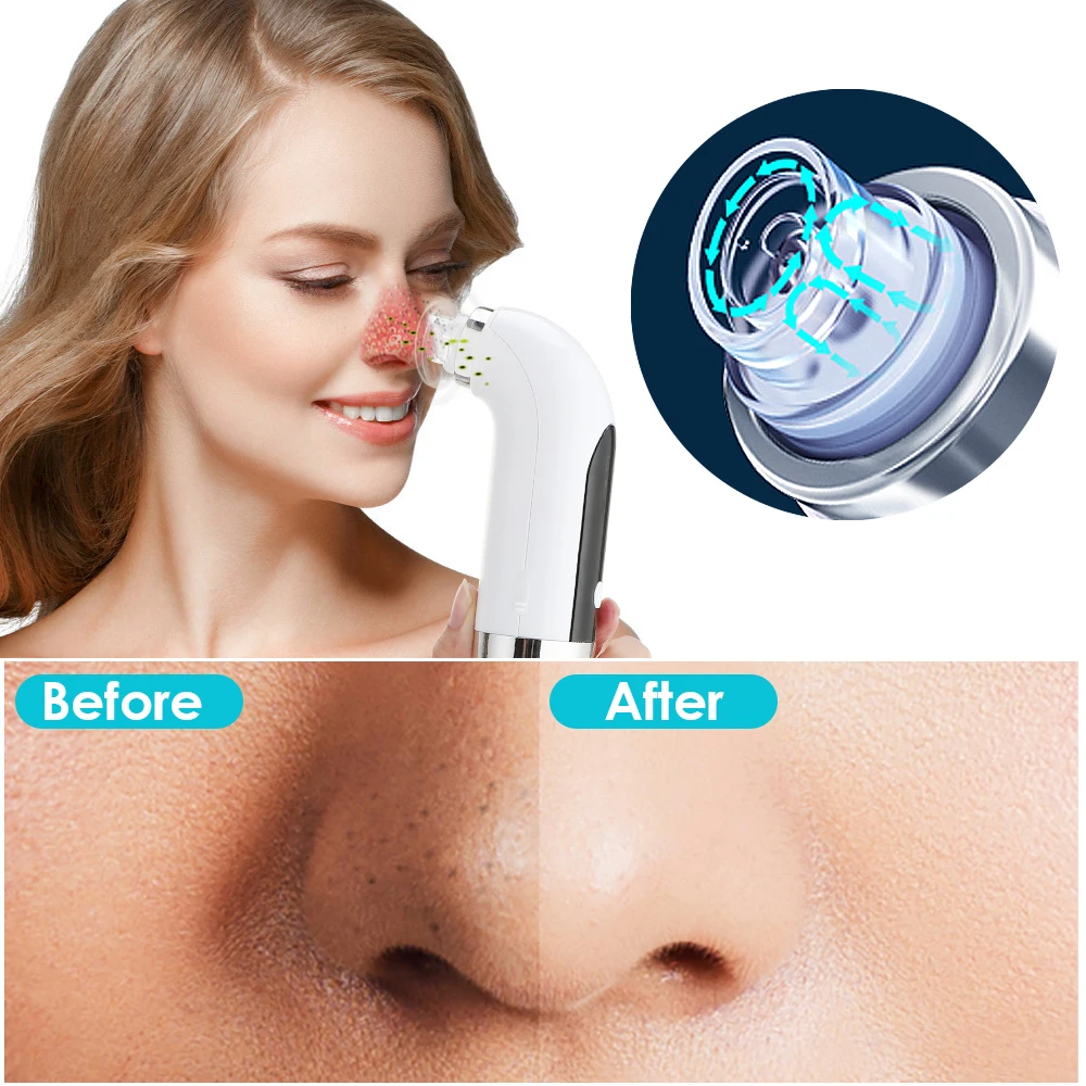 Blackhead Remover Pore เครื่องดูดฝุ่นไฟฟ้า Micro Small Bubble เครื่องทําความสะอาดผิวหน้า USB ชาร์จอุปกรณ์ความงาม