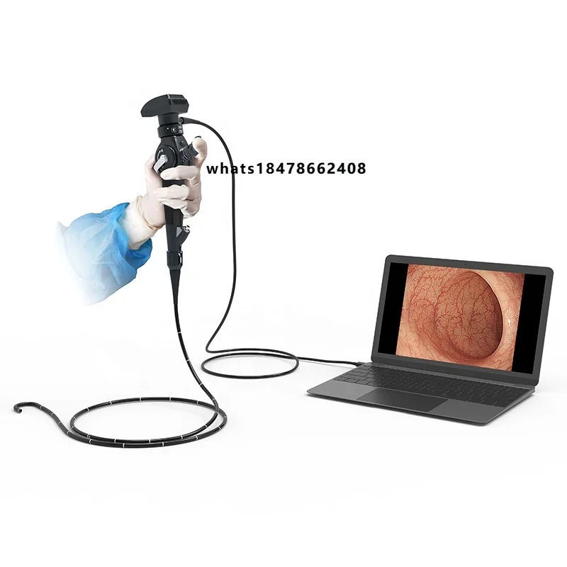 Ysenmed YSVET-EU150H Veterinary Endoscope for Horses, Cats,  Diagnostic and Functions, Insertion Tube Diameter 2.8-4 m