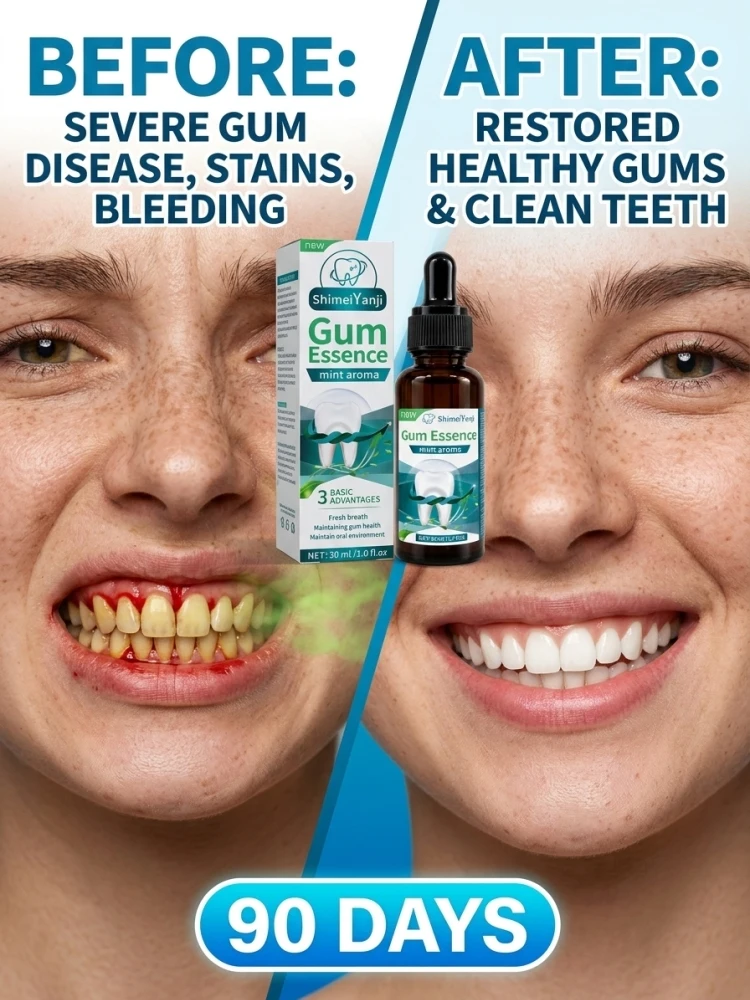 Portable Gum Care Essence Drops, Gentle Formula Cleans Teeth and Oral Surface, Delivers Cool Soothing Sensation, Nurture Gums with Long-lasting Fresh Scent for Daily Oral Care