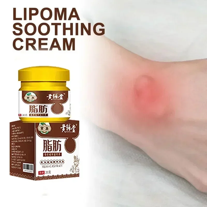 Lipoma Removal Cream บรรเทาบวมครีมกําจัดไขมันลบ Subcutaneous Lump Extract Care Fat Bulges Lump