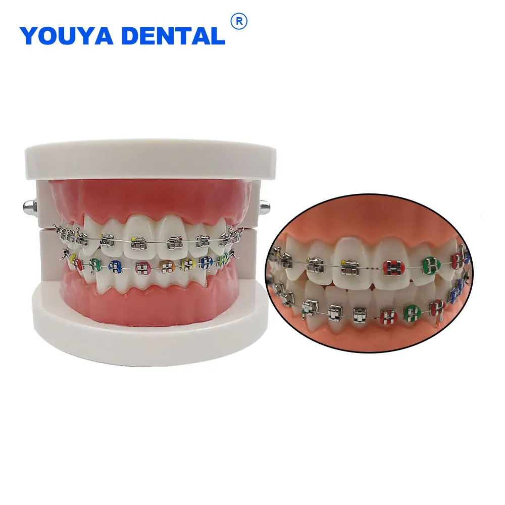 Orthodontic Teaching Model With Bracket Arch Wire Self-Ligating Metal Ligature Ties Standard Metal Brackets For Patient Demo