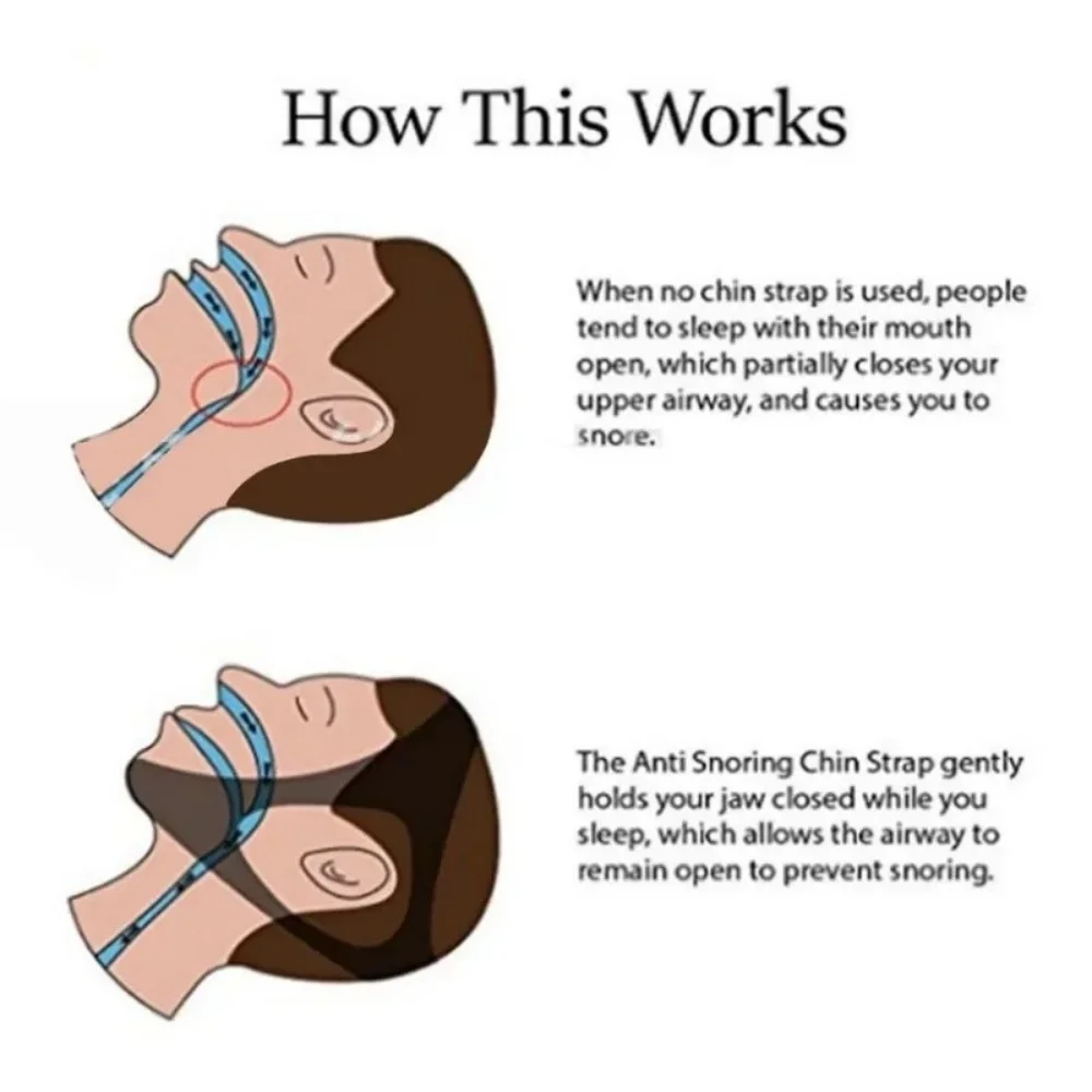 Adjustable Anti Snore Belt for Snoring Relief Breathable Chin Strap Night Sleeping Aid Jaw Support Men Women Snoring Protection - view 5
