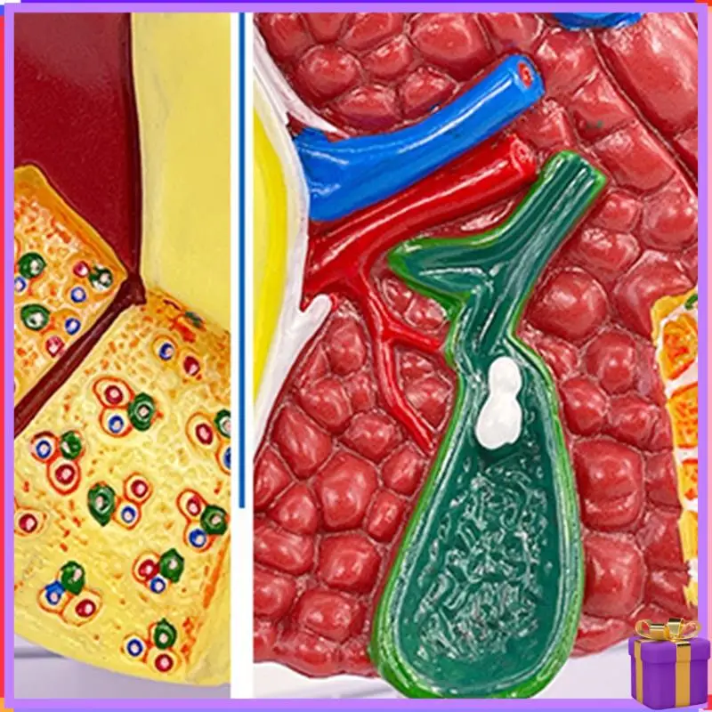 

Liver Model Pathological Liver Model For Common Pathologies, Liver Model Human Anatomy Office Anatomy Model