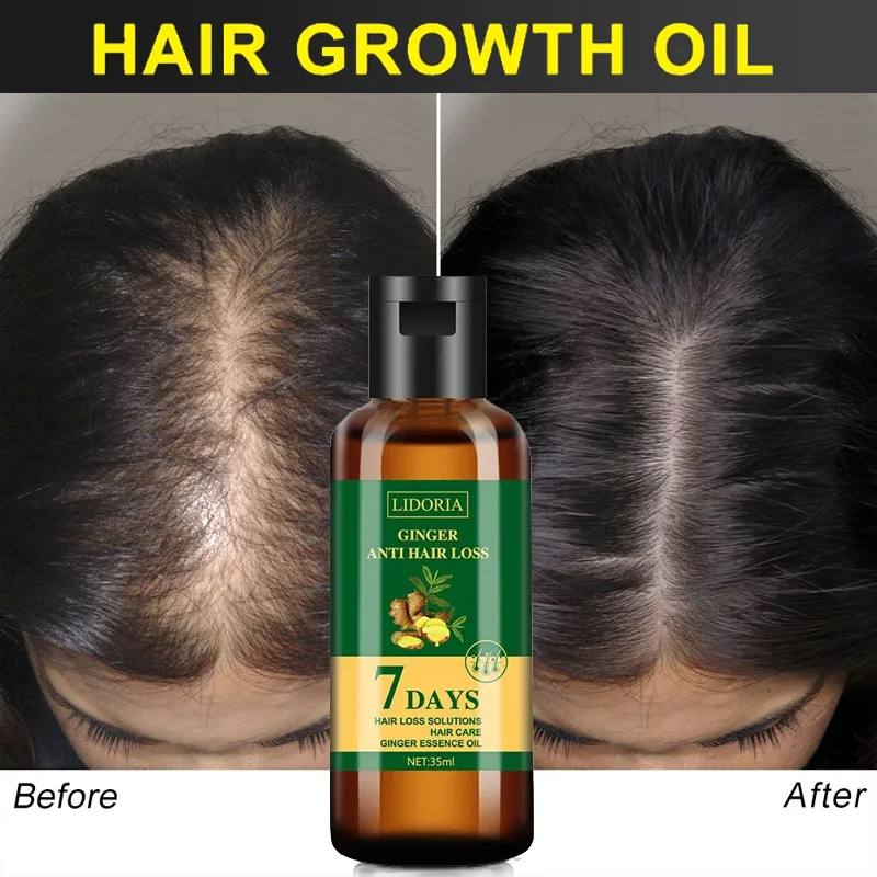 Ginger Hair Growth Essential Oil Anti-loss Hair Regrowth Serum Fast Growth Prevent Baldness Treatment Alopecia Hair Care Product