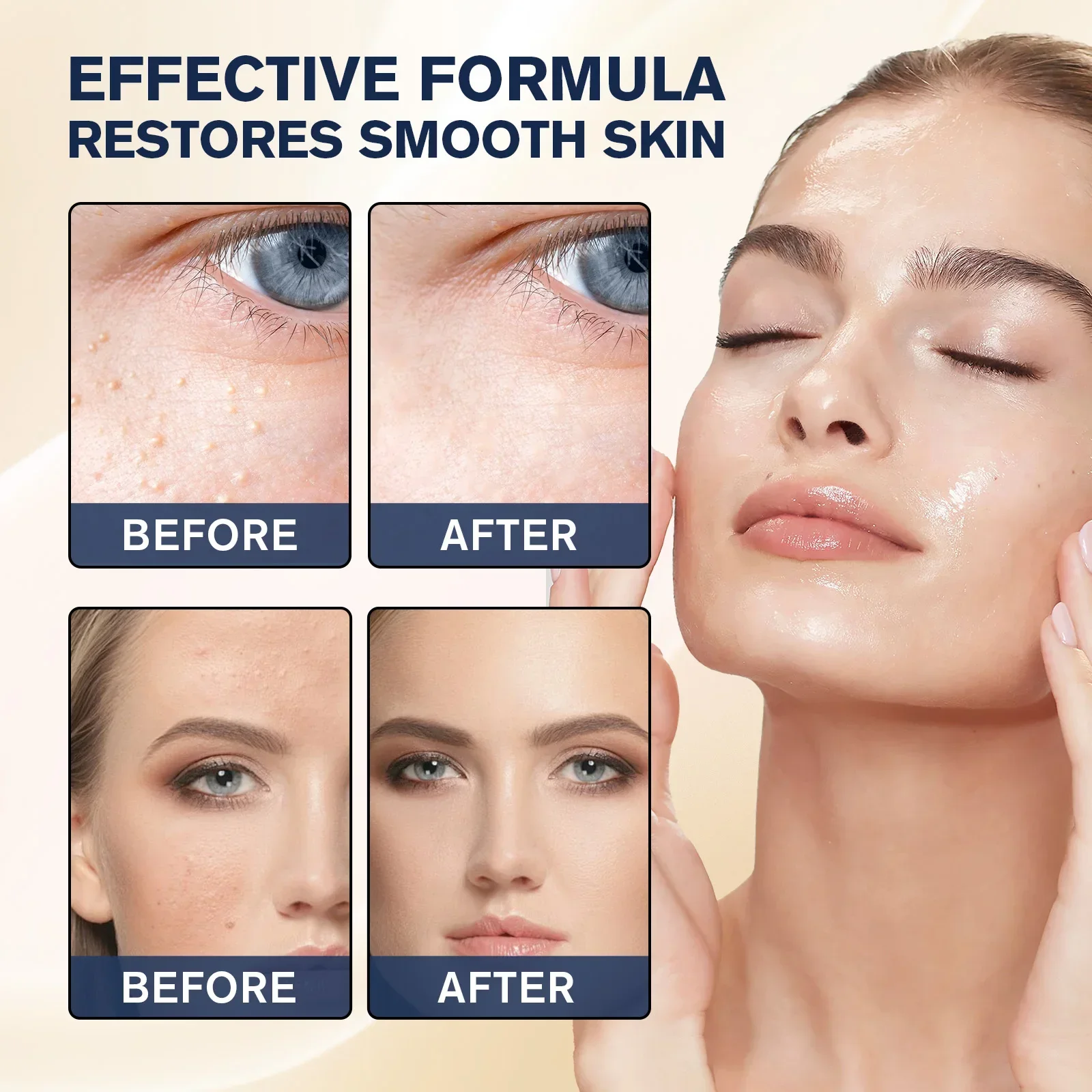 Eliminador de Milia, tratamien - Hyaluronic Acid Serum reseña y precio