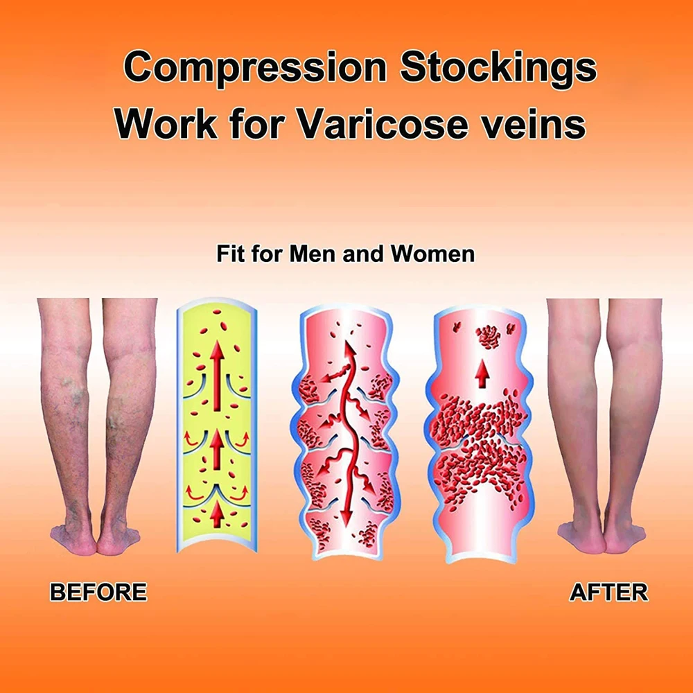 Medical Calf Compression Sleeve 30-40mmhg Men Women Footless Calves Compression Sleeves Varicose Veins