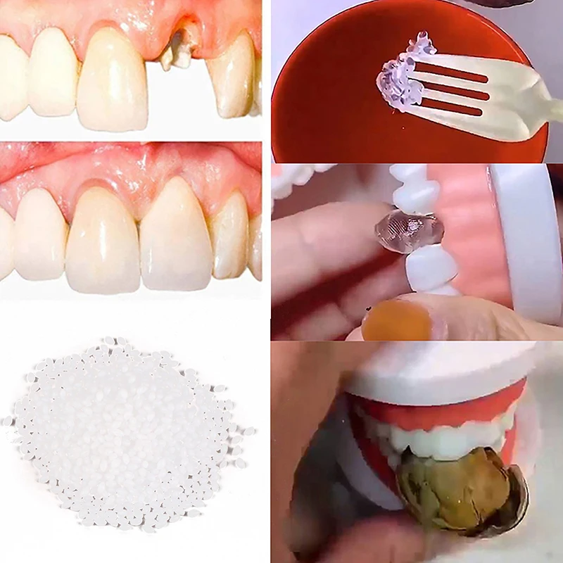 Kit de Reparo Temporário Dente, Dentes Falsos, Cola Sólida, Adesivo Dentário, Clareamento Dente, Beleza, Dentadura, Lacunas, 25g