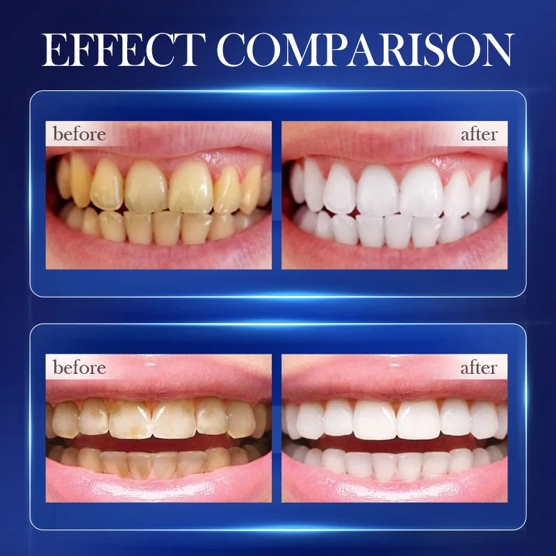 베이킹 소다 프로바이오틱 표백 치약 리무버 얼룩은 치아를 깨끗하게합니다 깨끗한 구강 위생 호흡 치아 미백 치약