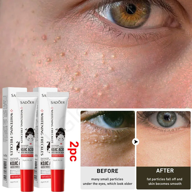 Fat Granules Remover Eye Cream Remove Dark Circle Anti-Puffiness Firming Cream Antiaging Fade Fine Line Repair Skin Barrier Care