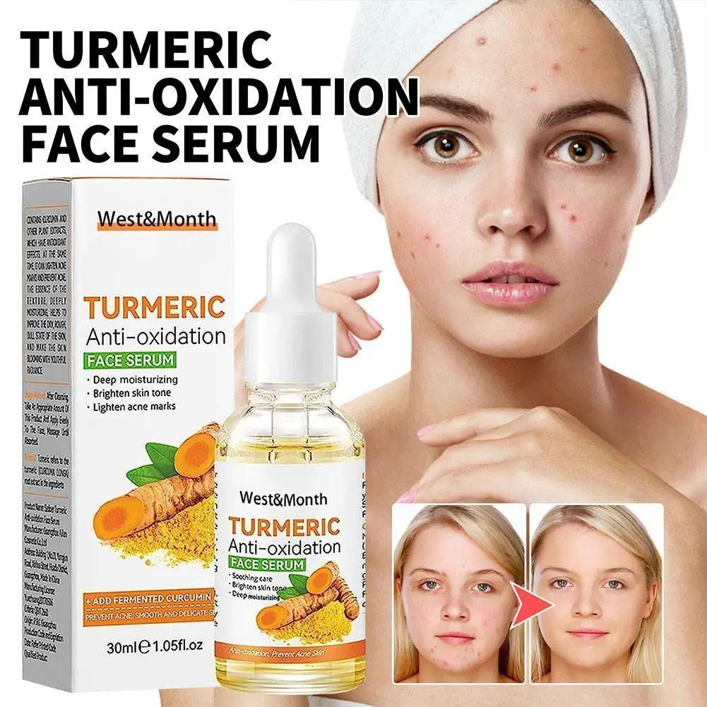 Turmeric Facial Essence Can Lighten Spots Acne Marks Moisturize Brighten And Moisturize Skin Turmeric Anti-oxidation Essence