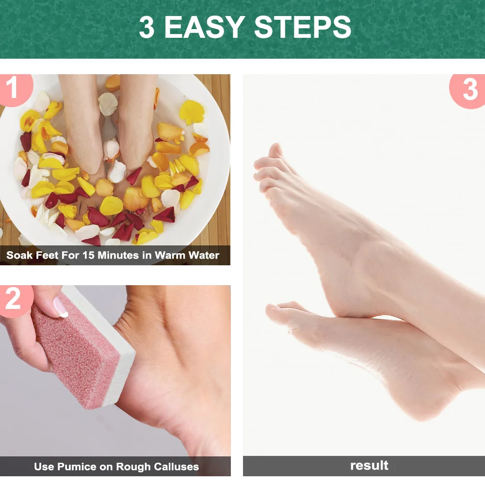 4 unids/pack de piedra pómez de vidrio para pies, eliminador de callos de piel muerta, herramienta exfoliante de pedicura