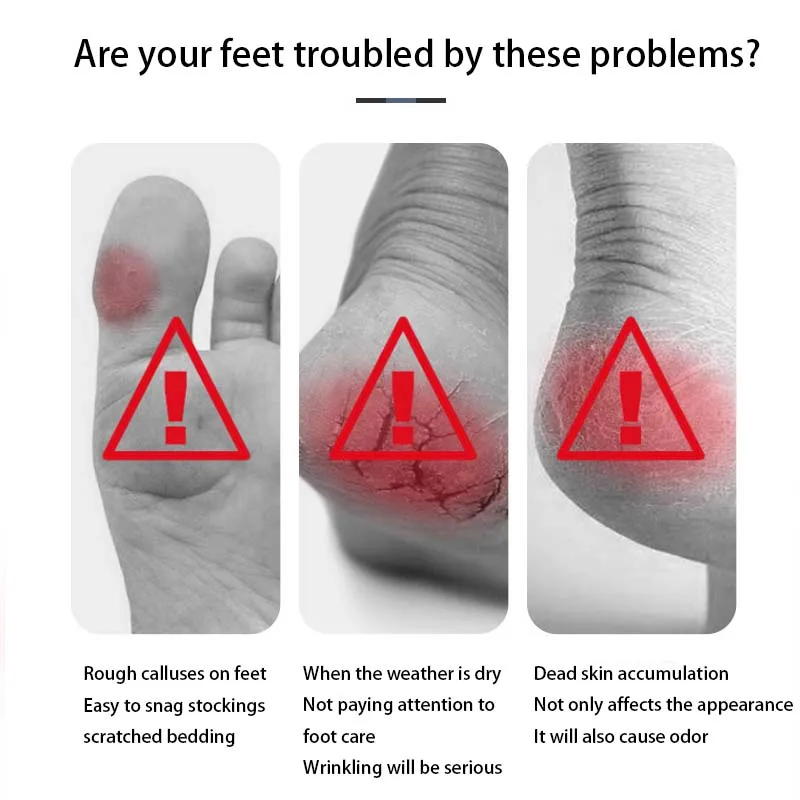 Piedras de pedicura, depuradores de pies, piedras pómez para pies, herramientas de exfoliación de pedicura para exfoliar la piel muerta