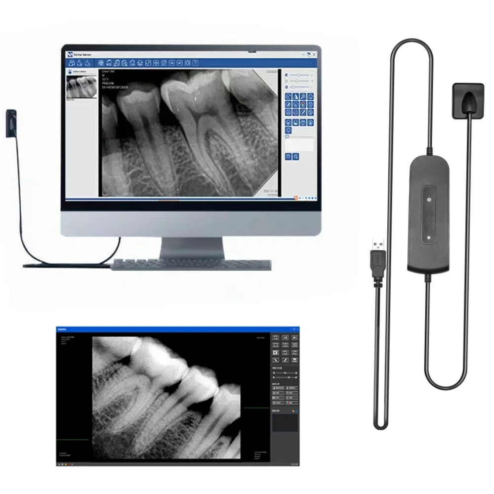 

Цифровой датчик стоматологии рентгеновский высокочастотный Rx стоматологический цифровой датчик стоматология цифровая Интраоральная система интраоральный инструмент изображения H D
