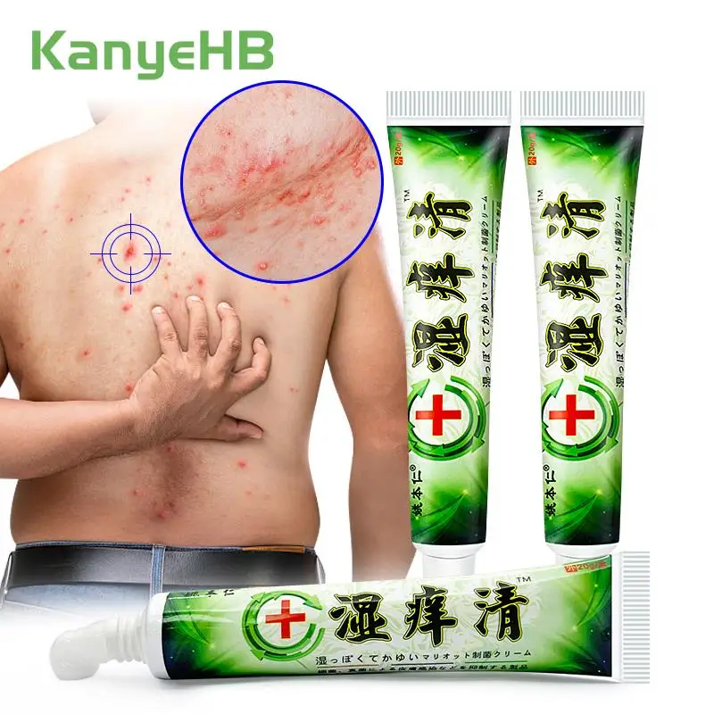 

3Pcs Psoriasis Ointment Eczema Dermatitis Urticaria Unguent Antibacterial Chinese Herbal Medicine Cream Relieve Skin Itch A1020