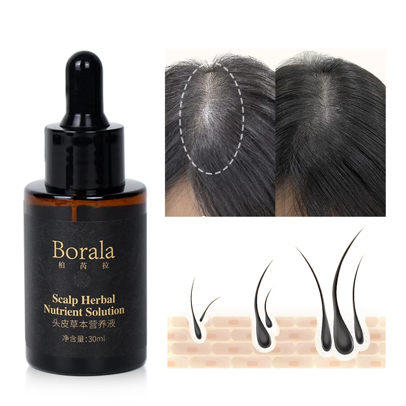 kit-de-suero-para-el-crecimiento-del-cabello-tratamiento-anticaida-previene-la-calvicie-fortalece-las-raices-esencia-de-cuidado-del-cuero-cabelludo-de-rapida-absorcion-y-no-grasosa