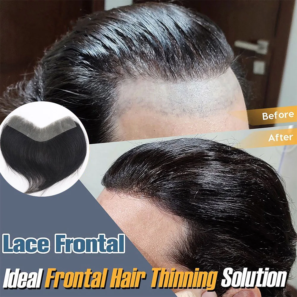 Thin Skin Men Toupee For Forehead V Shape
