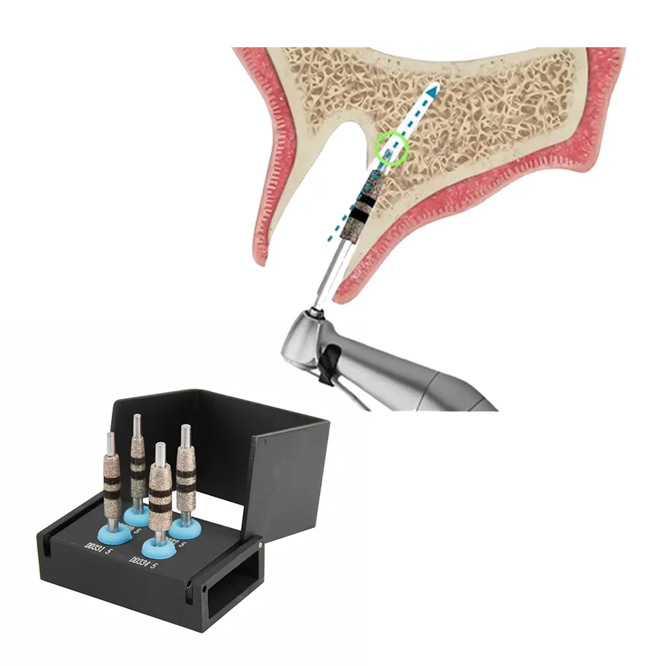 Toboom Dental Implant Guide Drill FG7604 Implant Neck Correction Countersink Drill Bit High Speed Bur Oral Surgery Supplies