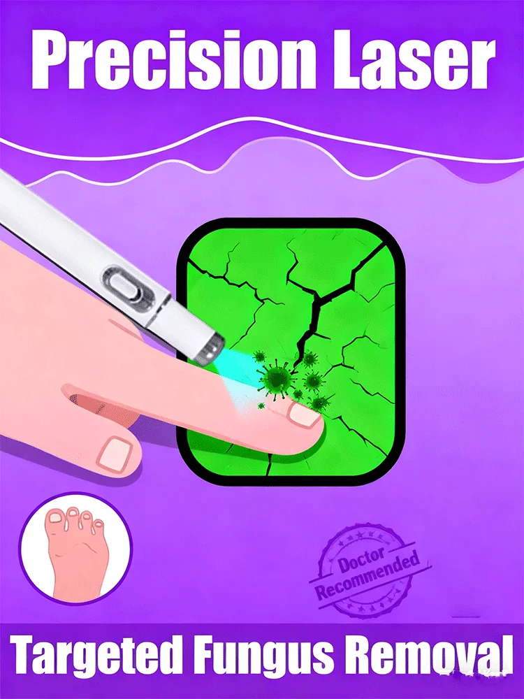 Nagelbürste Blaulicht-Laserwerkzeuge der zweiten Generation