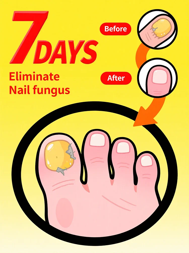 

Quickly eliminate fungus and restore healthy nails