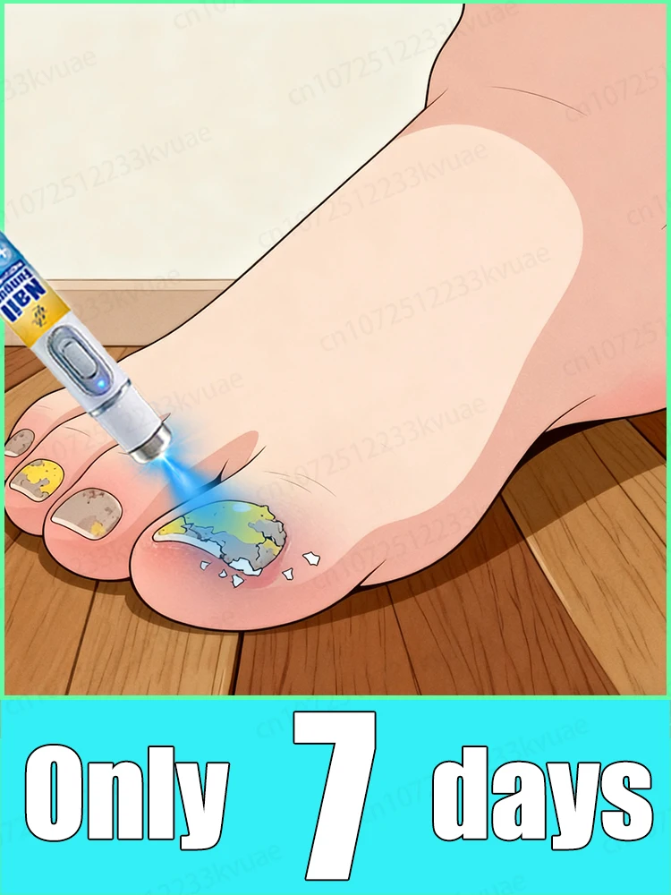 

No damage to nails, no recurrence, say goodbye to onychomycosis quickly