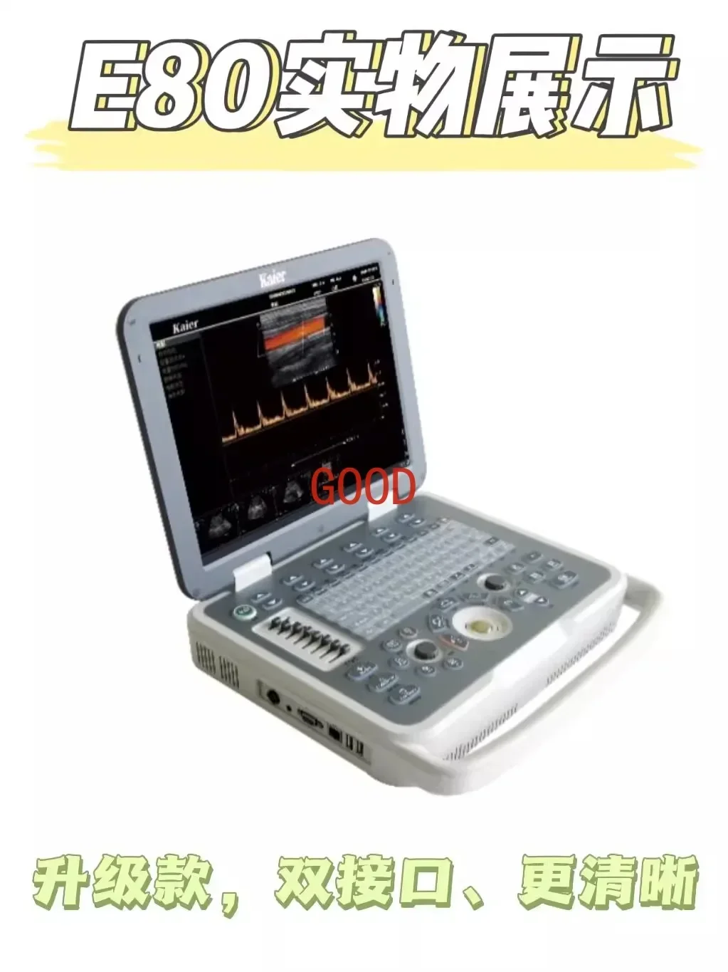 Portable ultrasound available