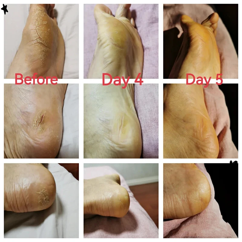 Effective Chinese Anti-Drying Crack Foot Cream Heel Cracked Repair Cream Removal Dead Skin Foot Mask Chapping Care 33/55/85g