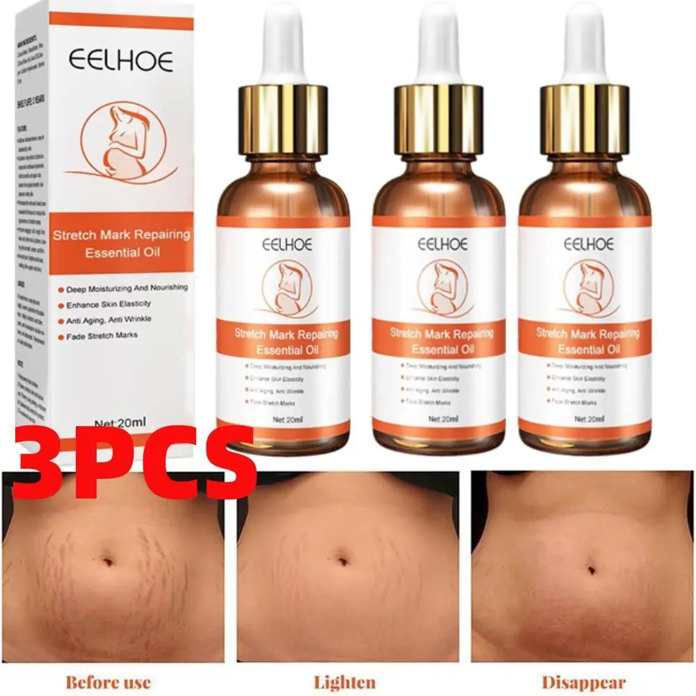 

3Pcs Stretch Marks Removal Essential Oil 20ml Maternity Stretch Care Firming Body Old Cream Removal Mark Skin New Repair