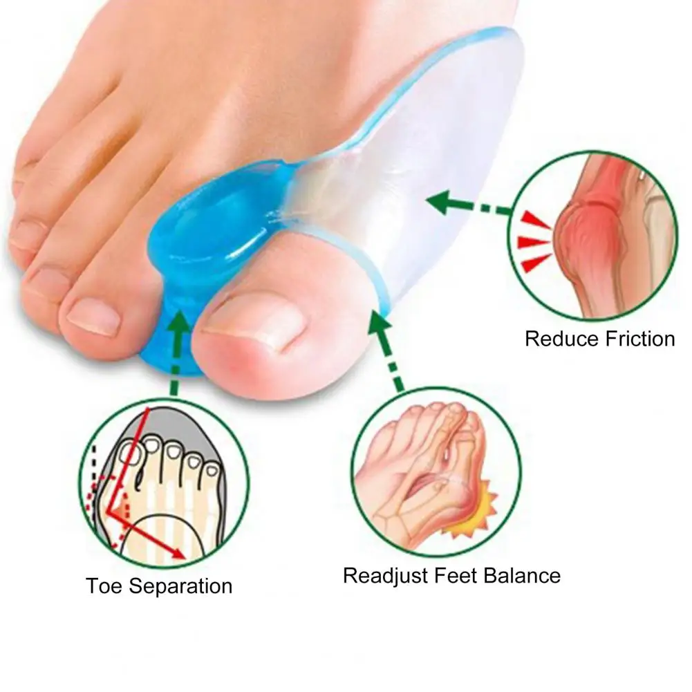 Hallux 외반 교정용 발가락 분리기, 발가락 뼈 보호대 쿠션, 부드러운 부니온 교정기, 10 쌍