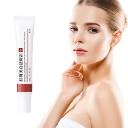 Effective Freckle Cream Fast Brighten Face Remove Melasma Dark Spot Fade Melanin Whiten Anti-pigmentation Improve Dullness