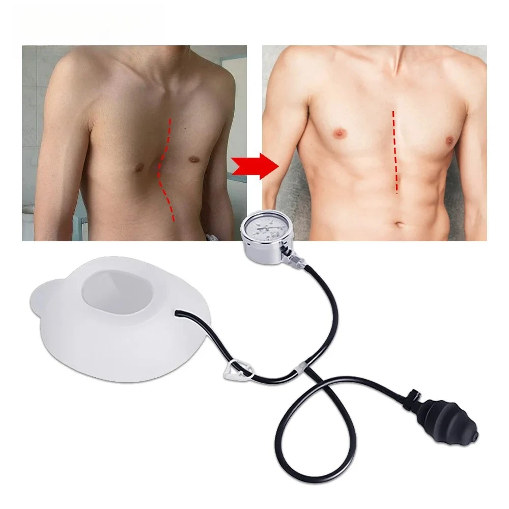 Pectus Excavatum Vacuum Bell,Pectus Excavatum Orthosis Brace,Sternal Depression Support Sunken Chest-Physical Chest Correction
