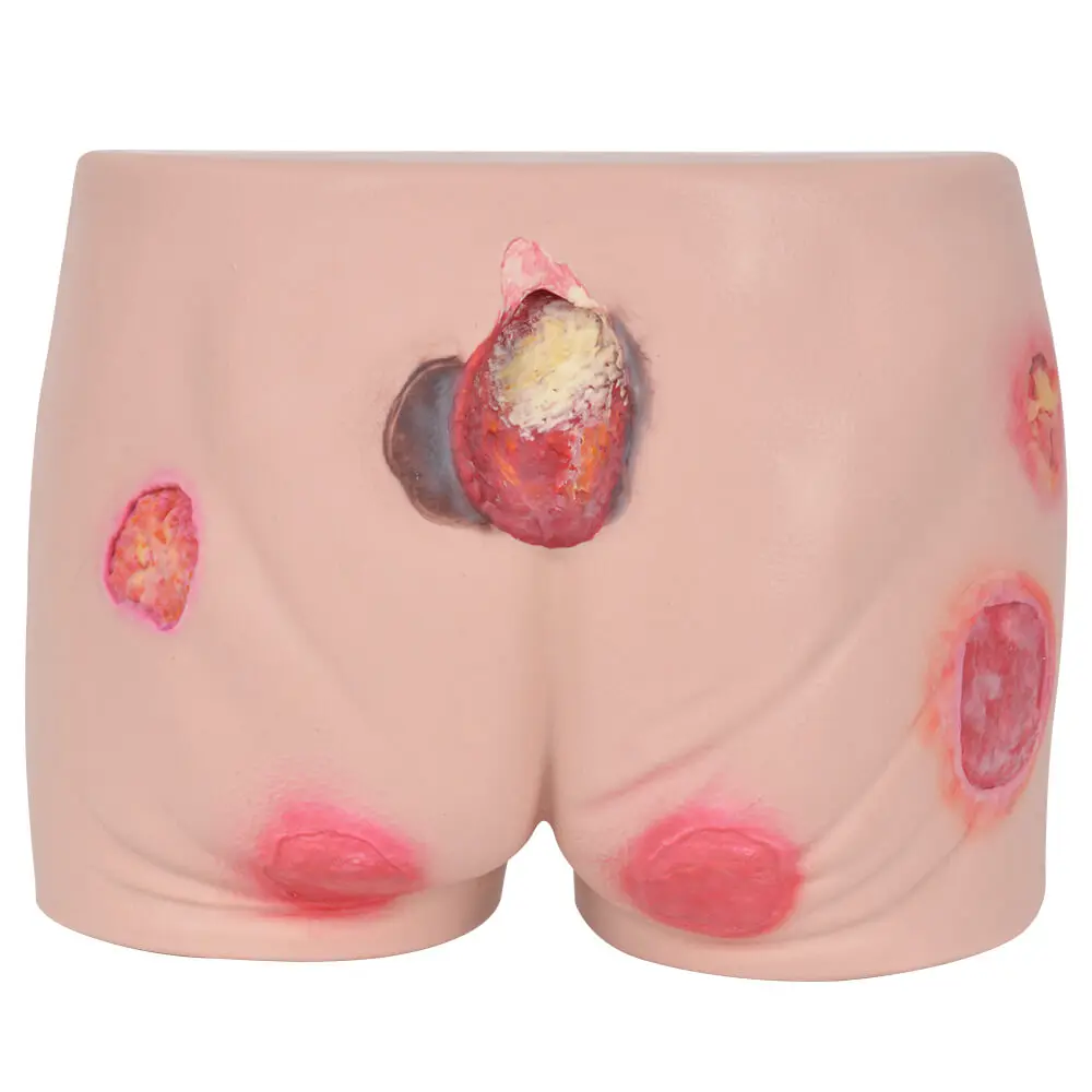 

Silicone Buttocks Pressure Ulcer Simulator