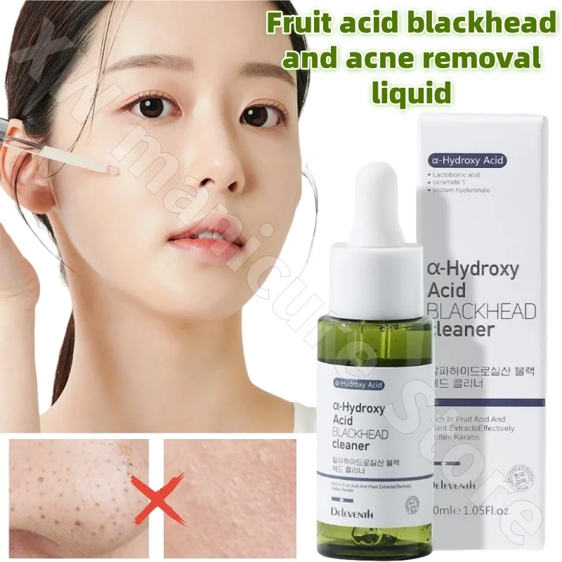 

Fruit Acid Original Solution To Remove Blackheads Remove Acne Shrink Pores Deep Cleansing and Moisturizing Essence 30ml