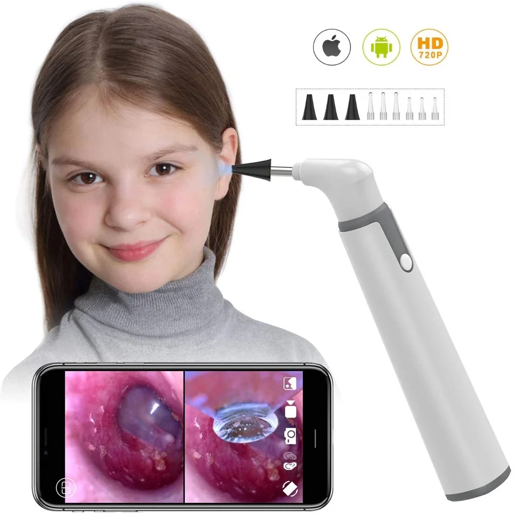 Top Wireless otoscopio Ear Camera 3.9mm 720P HD WiFi Ear Scope con 6 luci a LED per bambini e adulti supporto Android e iPhone