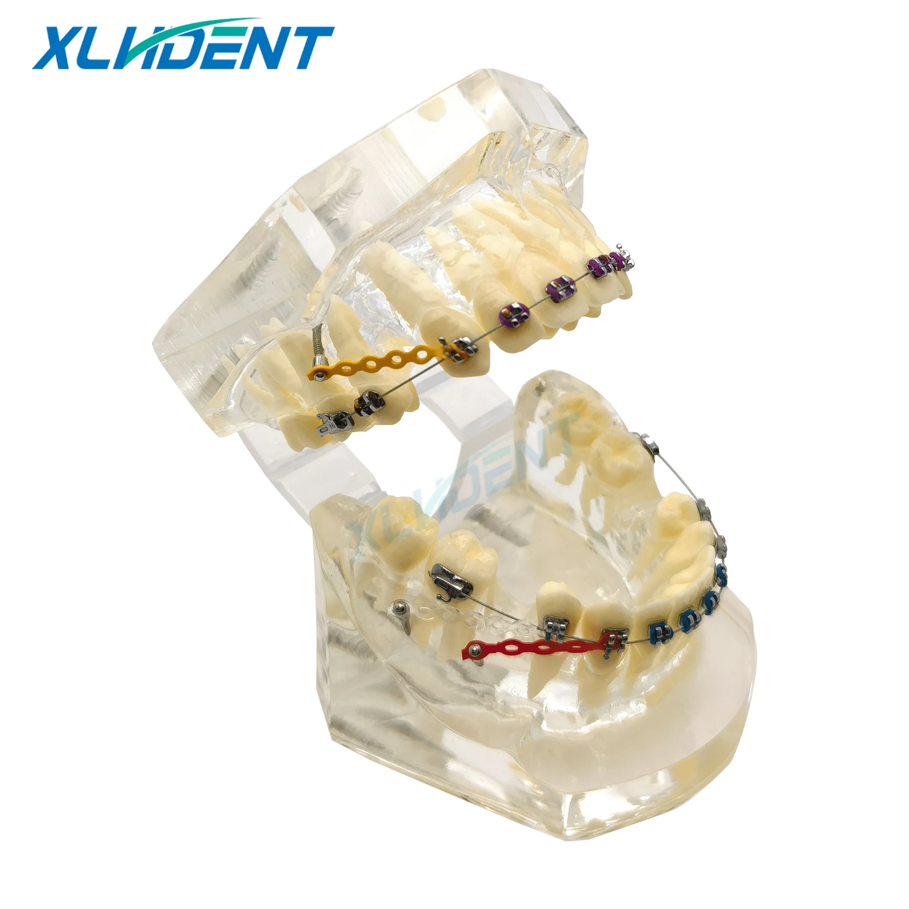 نموذج طب الأسنان مع قوس تقويم الأسنان للطبيب المريض الاتصالات علاج طبيب الأسنان نموذج مظاهرة نموذج طقم أسنان