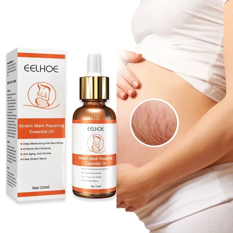 Stretch Mark Remover Repair Essential Oil Treatment Cream Maternity Anti Wrinkle Firming Anti Slackline Pregnant Oils Skin Care