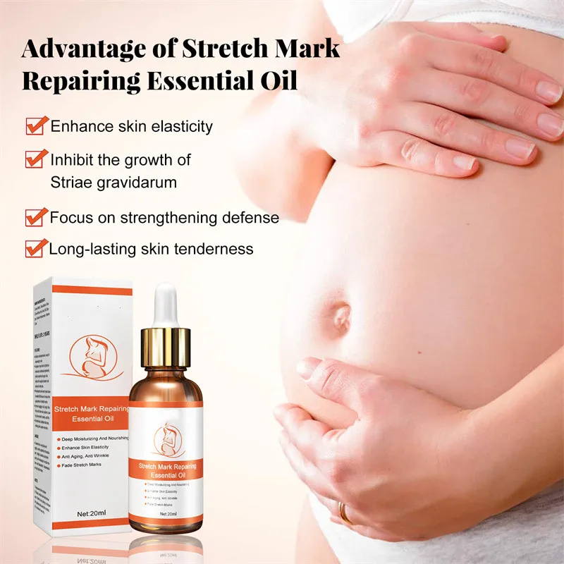 Stretch Marks Removal Oil Pregnant Women Pregnancy Maternity Body New Old Stretch Mark Removal Cream Increase Elasticity of Skin