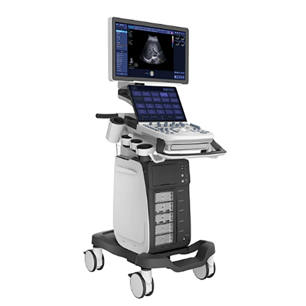 

SonoScape Ultrasound P15 Ultrasound Machine color doppler ultrasonido ecografo 3d 4d