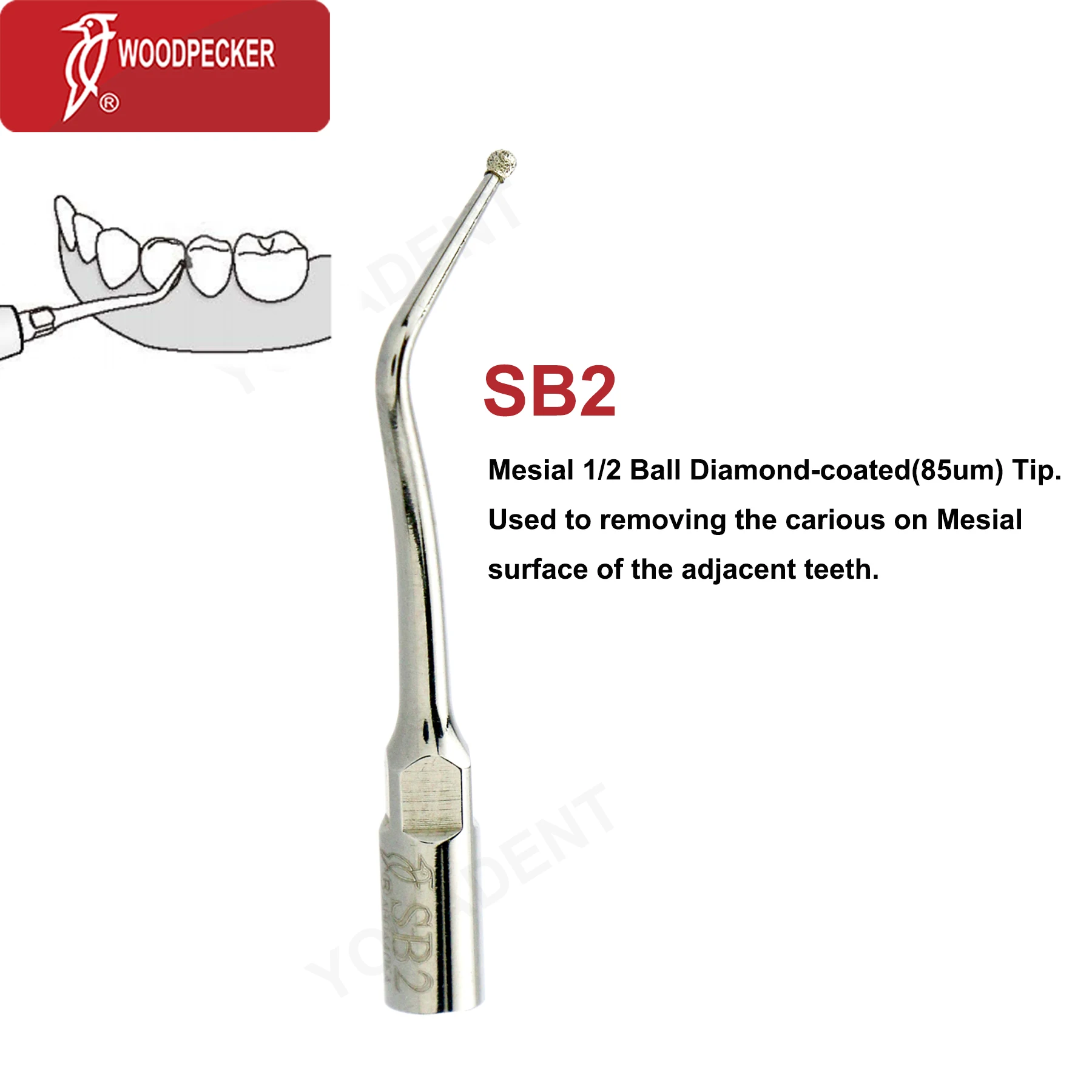 Original Woodpecker DTE Dental Scaler Tips Ultrasonic Scaling Tip Cavity Preparation Fit EMS SATELEC NSK Scaler Handpiece SB/SBD