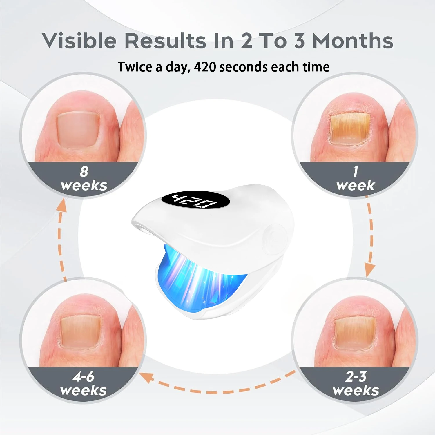 Household Nail Laser Treatment Device Light Therapy Onychomycosis Repair Tool for Men Women Portable Foot Nail Care for Travel