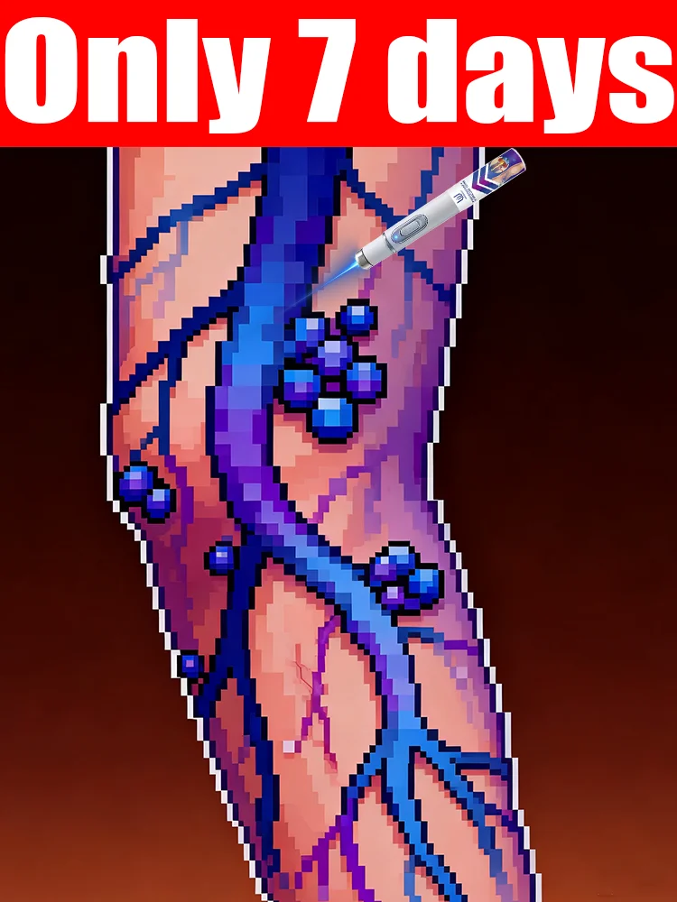 

Vᴀʀɪᴄᴏsᴇ ᴠᴇɪɴ ʟᴀsᴇʀ ɪɴsᴛʀᴜᴍᴇɴᴛ