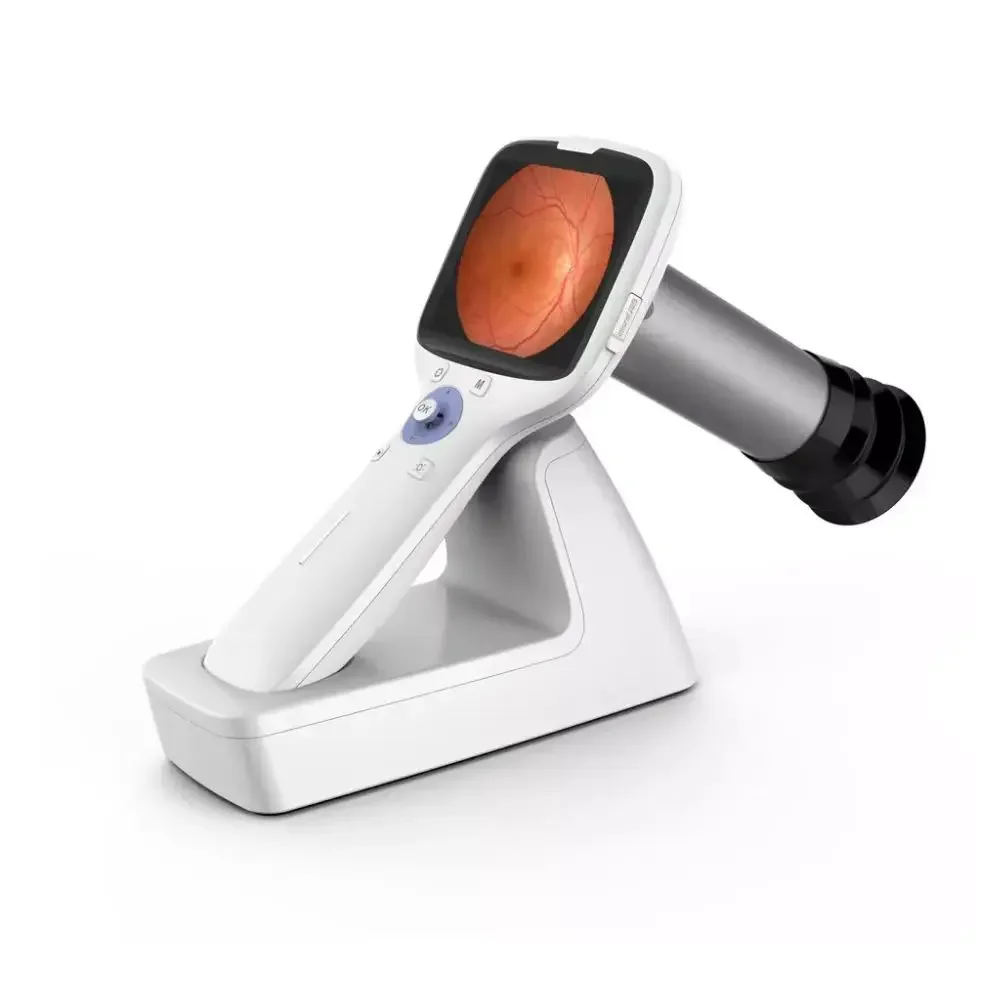 Smart F Vet Veterinary Equipment Portable Ophthalmic Equipment Handheld Retinal Fundus Camera for Animal