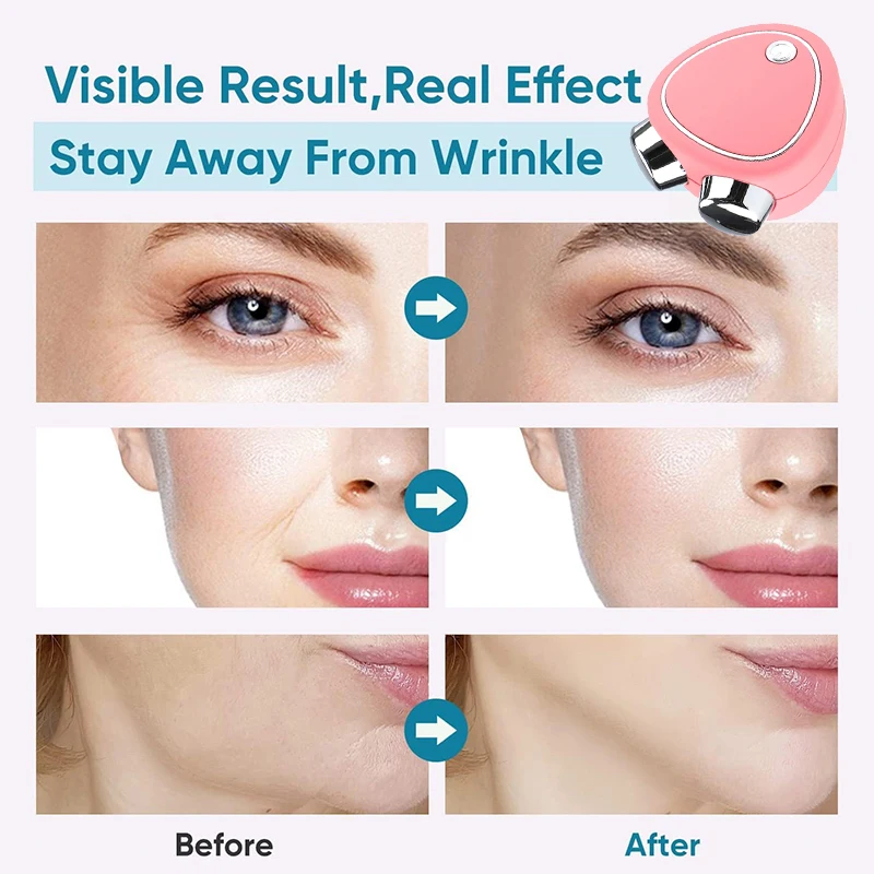 Máquina de Estiramiento Facial, masajeador Facial de microcorriente, rodillo EMS, rejuvenecimiento de la piel, herramienta de cuidado de belleza de la piel antiarrugas, nuevo