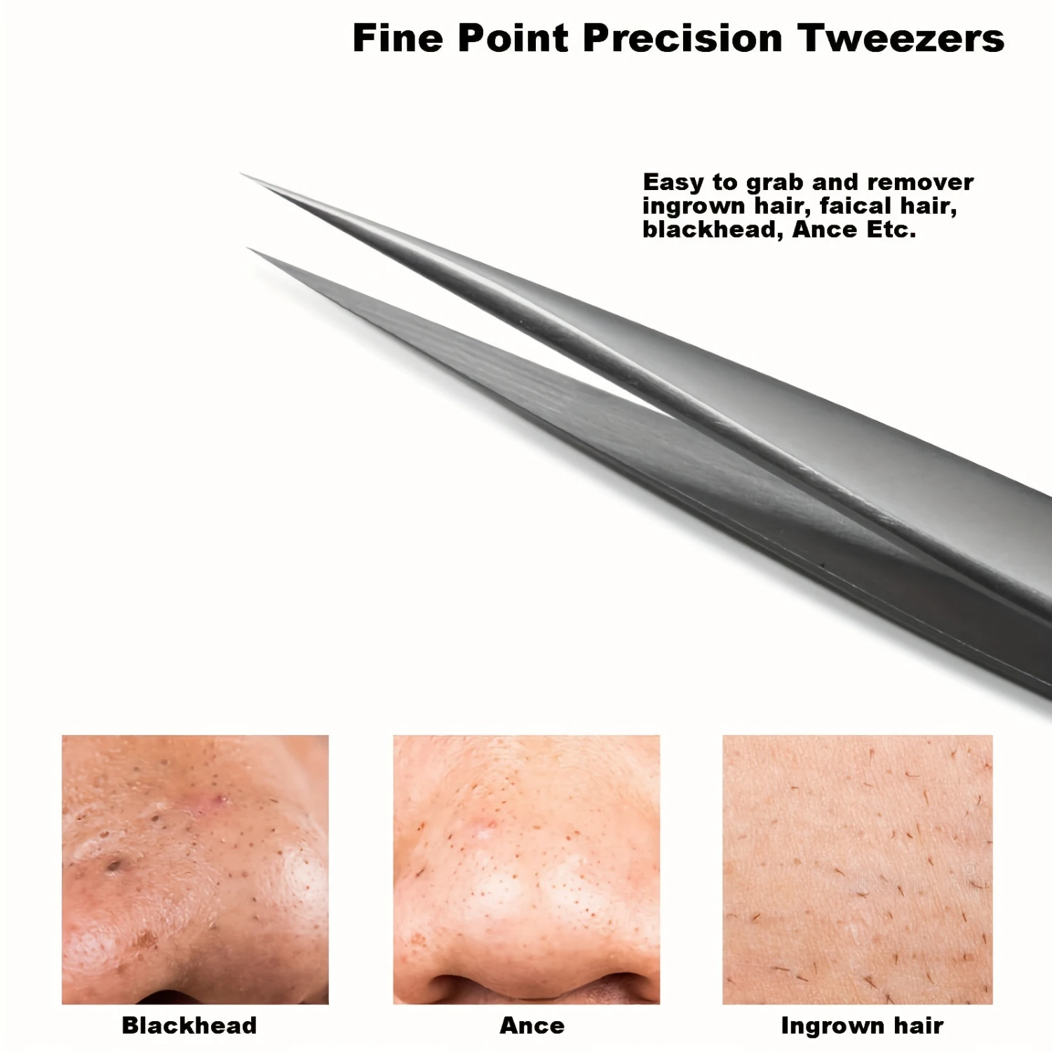 Precision Pointed Tweezer For Women And Men - Ingrown Hair Removal, Eyebrow, Facial Hair And Blackhead Remover Tool