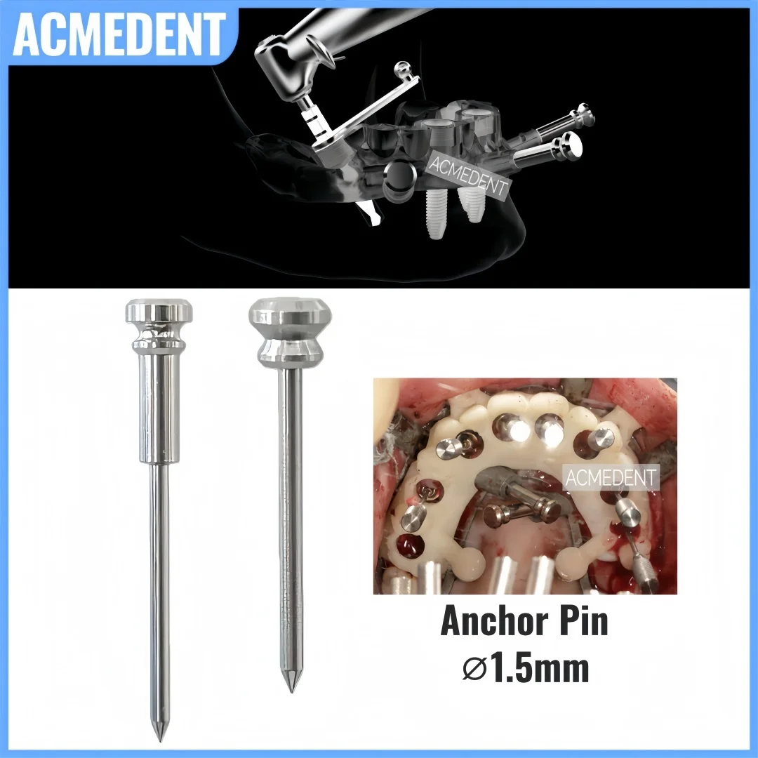 

⌀1.5*20 Dental Guided Anchor Pin Short&Long Universal Guide Sleeve Position Locator Tool Fixation Implant Guide Plate