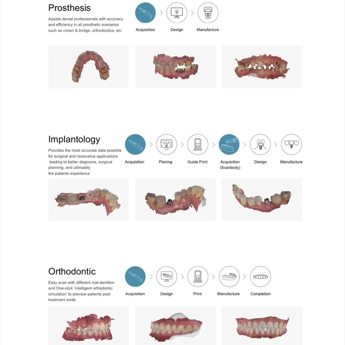 Runyes Dental 3,0 Pro Scanner 3D Ai Scan-Funktion Zahnmedizin Intra oral scanner Echt farbe für digitales Implantat/Kieferorthopädie