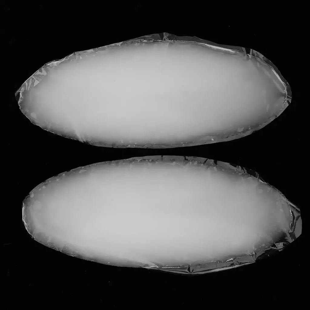 Silicone Leg Concealer Onlays Leg Straightening Pad O Leg Corrector Accessories for Daily and Office Fashion