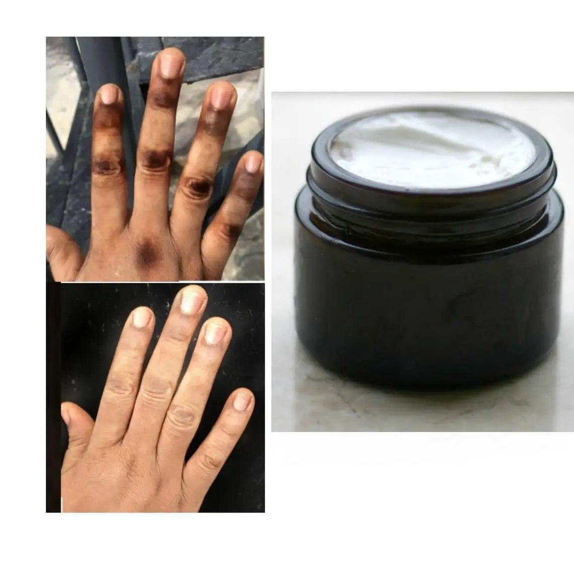 

Dark knuckles Eraser cream, Clean Knuckles, Beautiful Hands