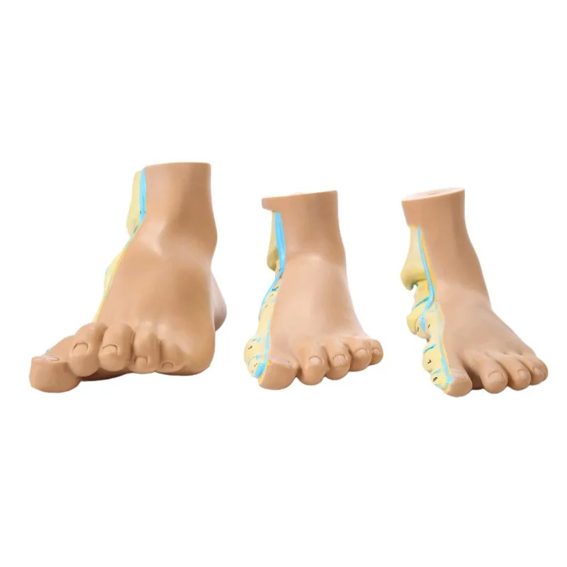 Life Size Foot Model Human Normal Flat Arched Foot Anatomical Model With Bones Muscle Ligament