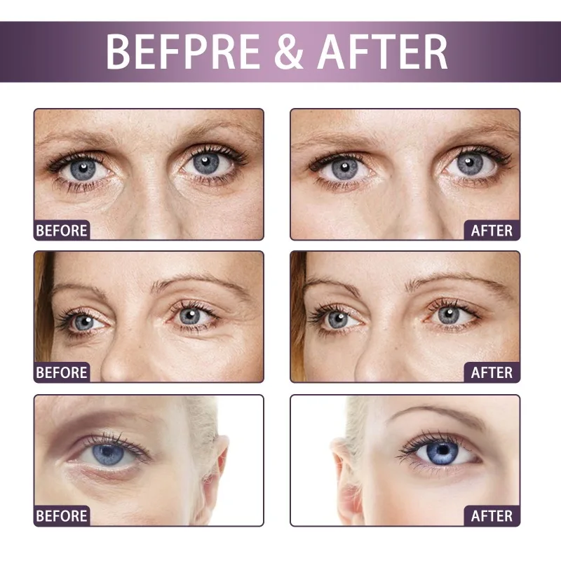 كريم مرطب مضاد للشيخوخة لتنعيم العين وتقليل التجاعيد للعيون الشبابية