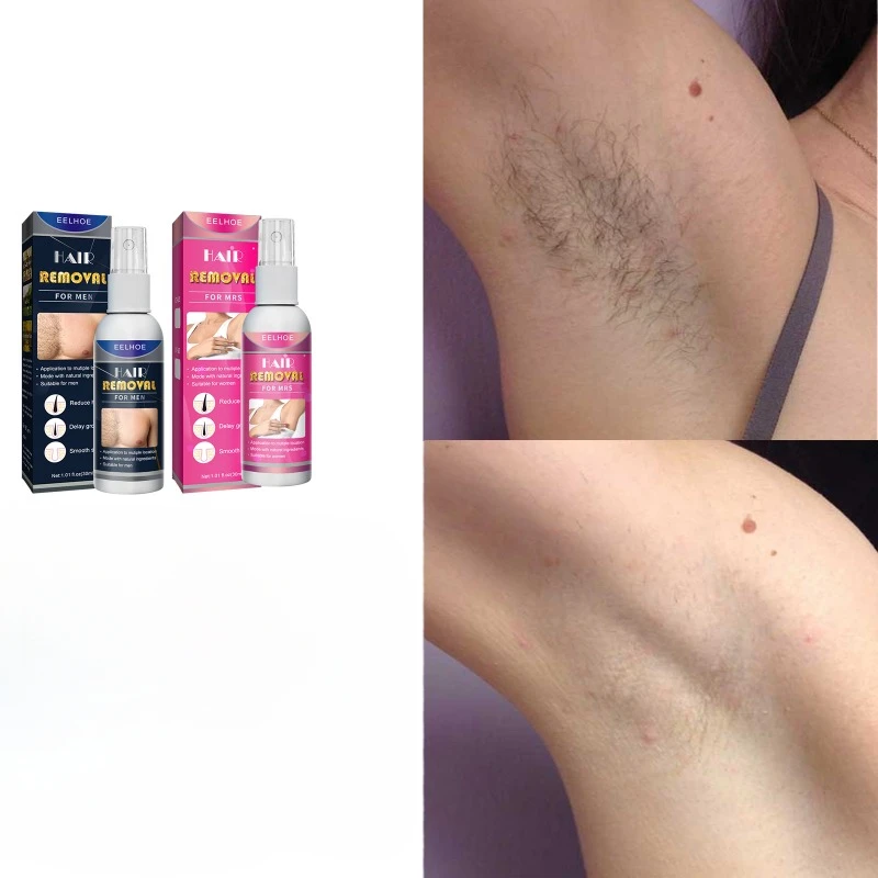 Armpit Gentle Hair Removal Spray Refreshing Non-irritating Delicate Smooth Painless Hair Growth Inhibitor for Ladies Men Repair